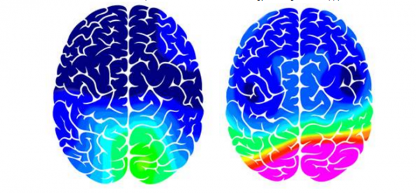 A brain scan showing someone thinking about their smart home (left) and someone thinking about their non-smart home (right) (Tony Sheffert and Duncan Banks/PA)