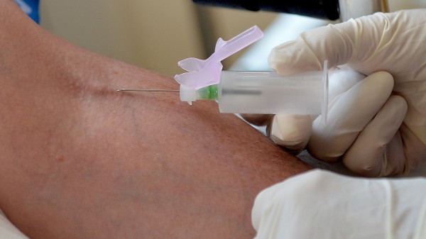 Cancer blood screening test.