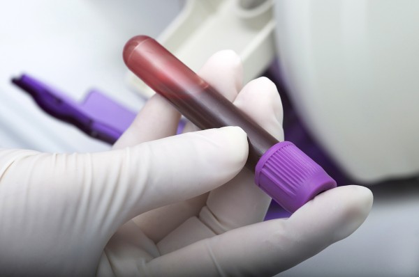Blood test.